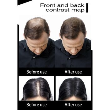 Hair Volumn Fibers (Black) 25g  