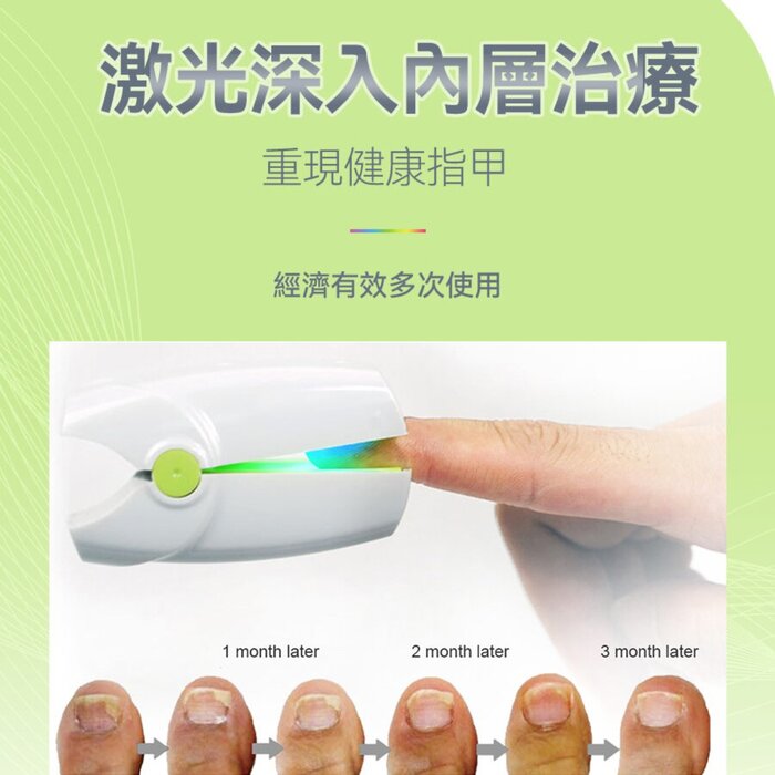 Newedo Onychomycosis Laser Therapy Device HZJ-01  Product Thumbnail