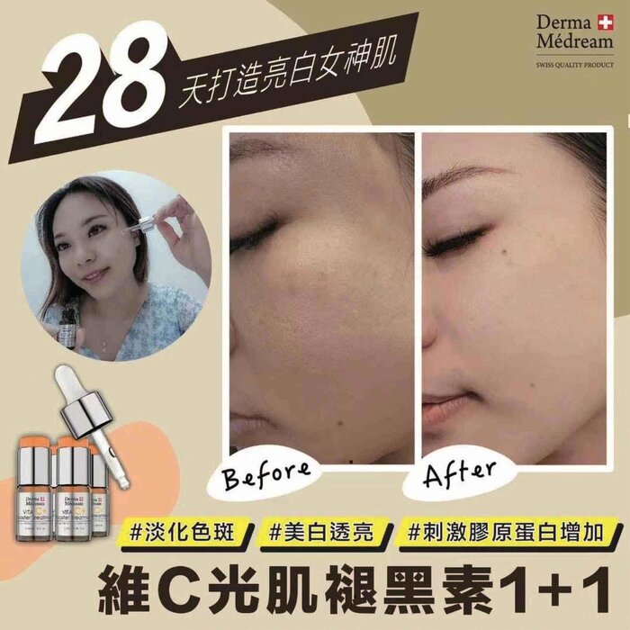 Derma Medream Vita C Booster Treatment Serum (Whitening, Acne Marks, Sensitive, Antioxidant, Pore Minimizing, Firming, Brightening) DM043 Fixed SizeProduct Thumbnail