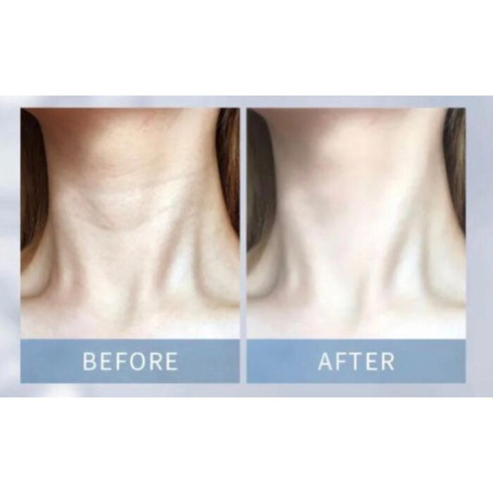 Perfect Healthy Beauty 柏希肌研 三段波提拉面部護理 Picture ColorProduct Thumbnail