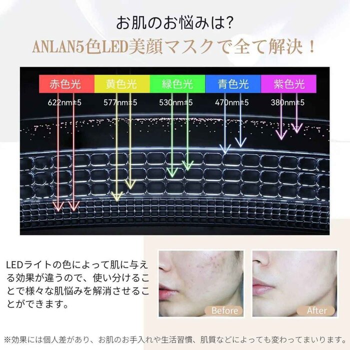 ANLAN New Japanese brand ANLAN upgraded version of IPL 3D mask Fixed SizeProduct Thumbnail