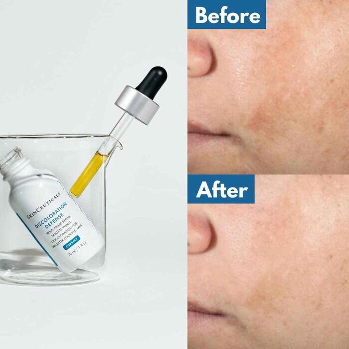 Skin Ceuticals Skin Ceuticals DISCOLORATION DEFENSE 30mlProduct Thumbnail