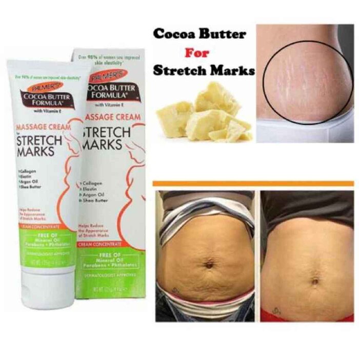 PALMERS Cocoa Butter Formula Massage Cream for Stretch Marks 125gProduct Thumbnail