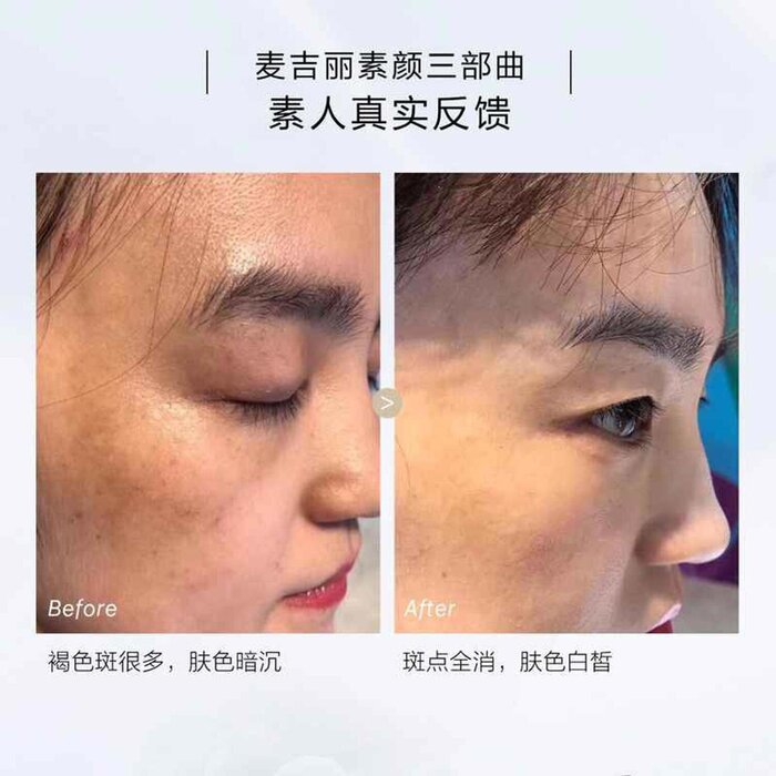 Mageline 3-Step Skincare Full Set (for dry and normal skin) 150ml, 35ml, 38Product Thumbnail