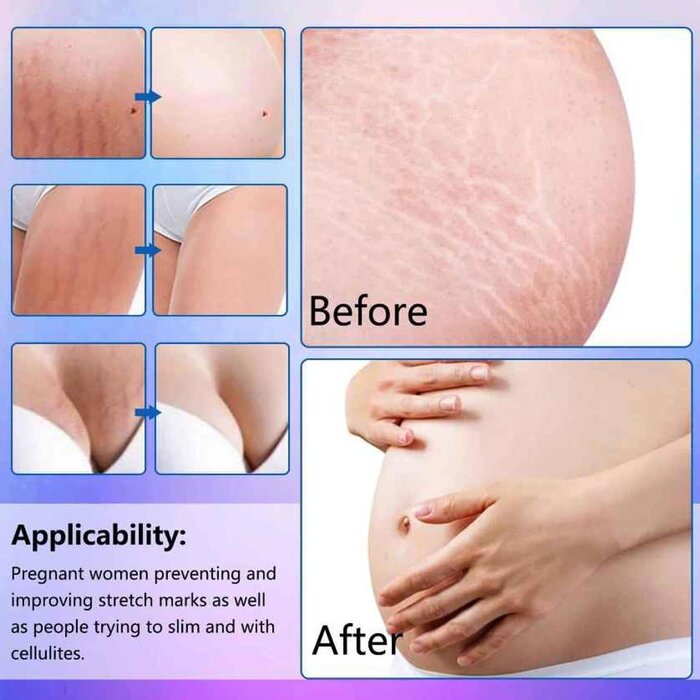 SEFUDUN Anti Stretch Mark Essential Oil 30mlProduct Thumbnail