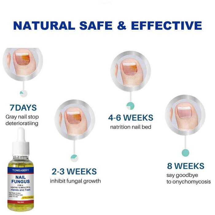 TONISABERY TONISABERY Nail Essence Treatment Solution For Onychomycosis 30mlProduct Thumbnail