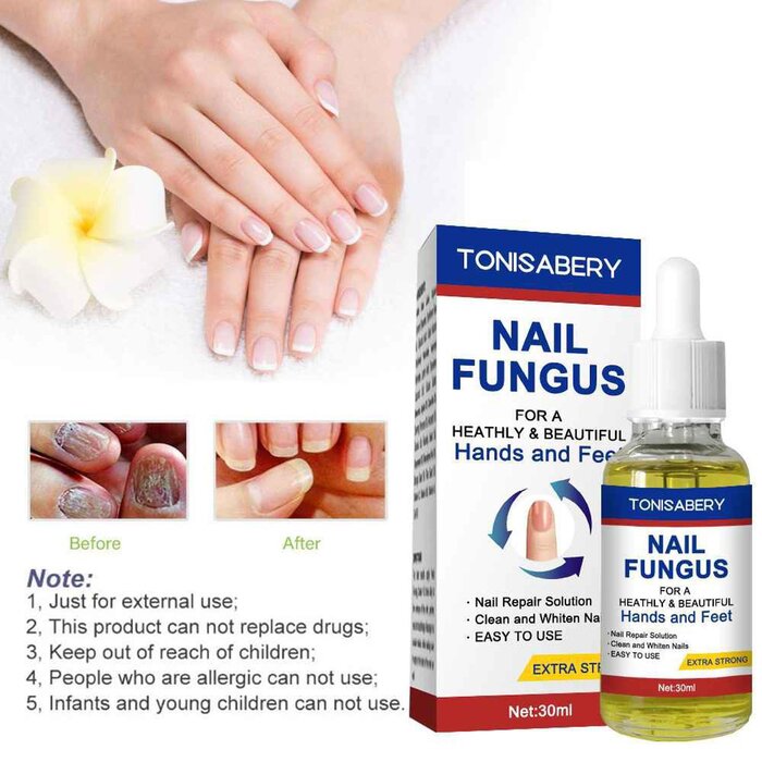 TONISABERY TONISABERY Nail Essence Treatment Solution For Onychomycosis 30mlProduct Thumbnail