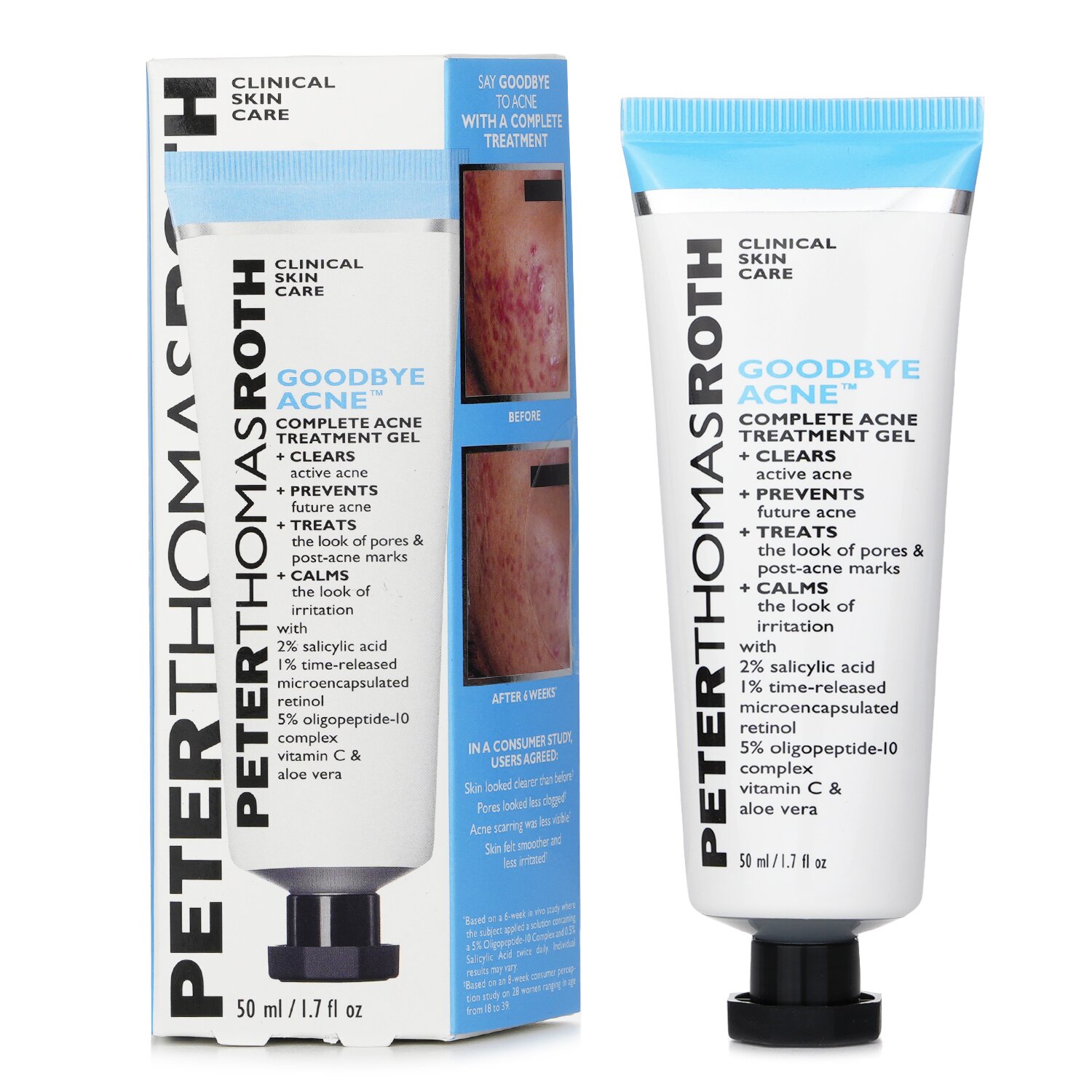Peter Thomas Roth Goodbye Acne Complete Acne Treatment Gel 50ml/1.7oz